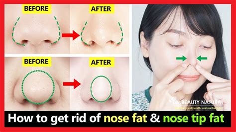 <b>Reduce</b> <b>Fat</b> from. . How to reduce nose fat
